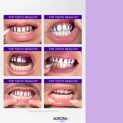 Purple V34 Whitening Strips - Each box contains 14 individual applications