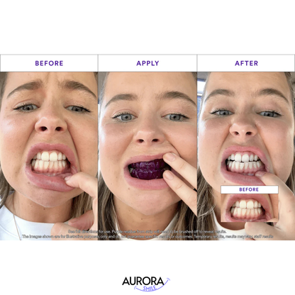 Purple V34 Whitening Strips - Each box contains 14 individual applications